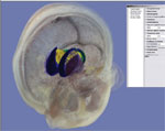 Application fo the upper limb anatomic model on orthopedics training